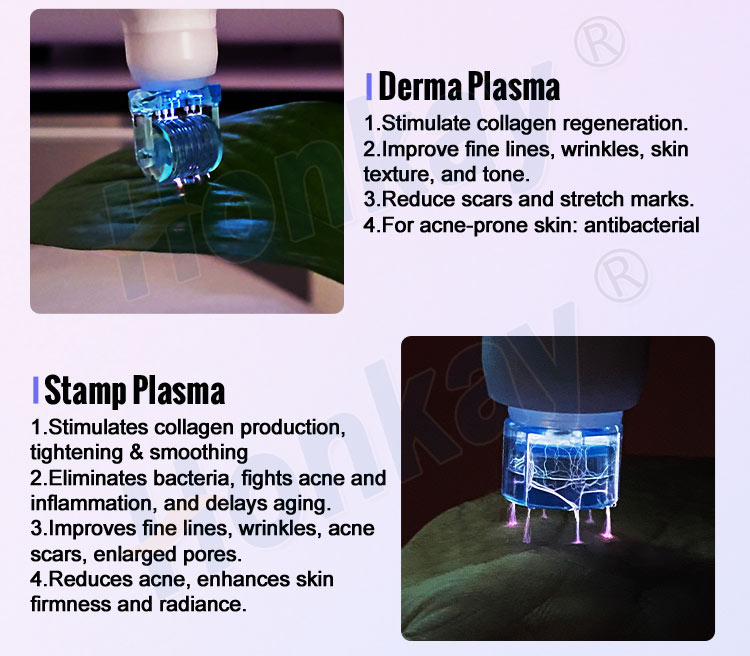 A-plasma-pen-wrinkle-removal-01