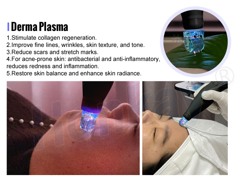 plasma pen fibroblast