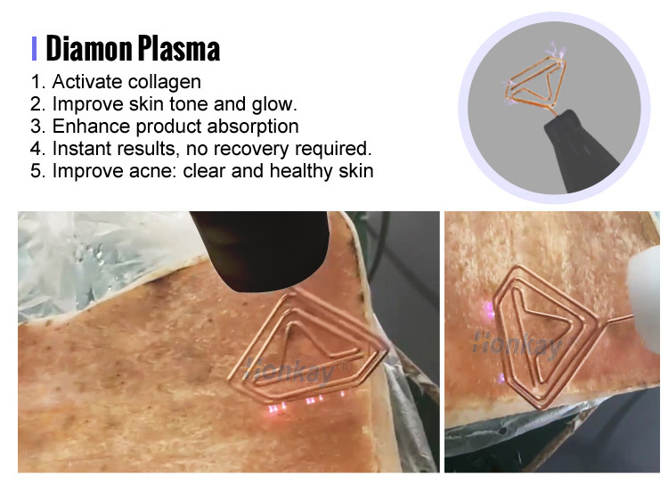 plasma pen fibroblast