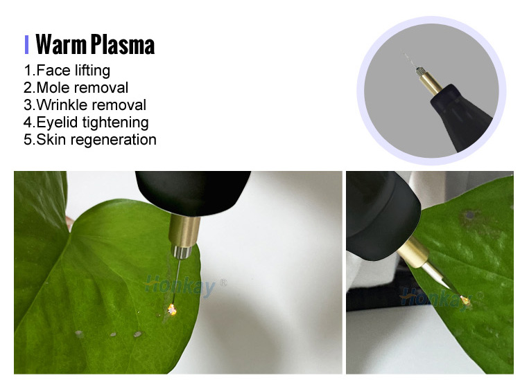 plasma pen fibroblast