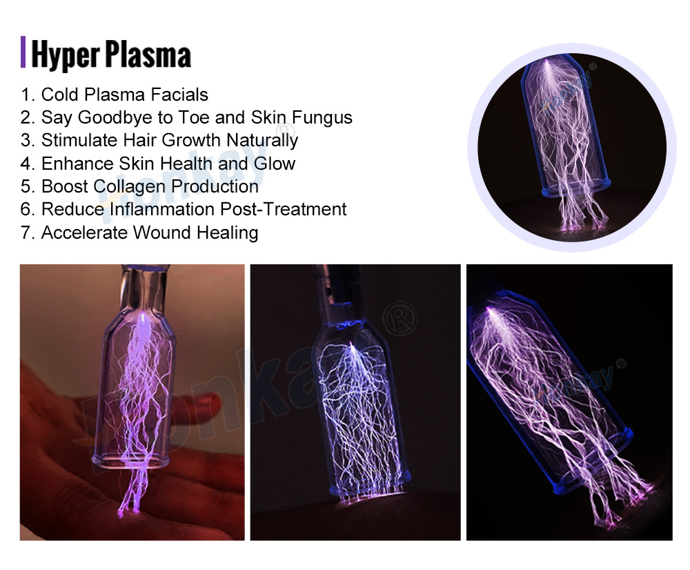 Hyper plasma head in use with visible plasma discharge inside the glass tip