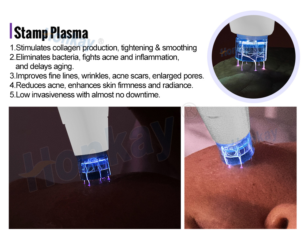 Stamp plasma head pressed onto skin with plasma visible under the contact plate