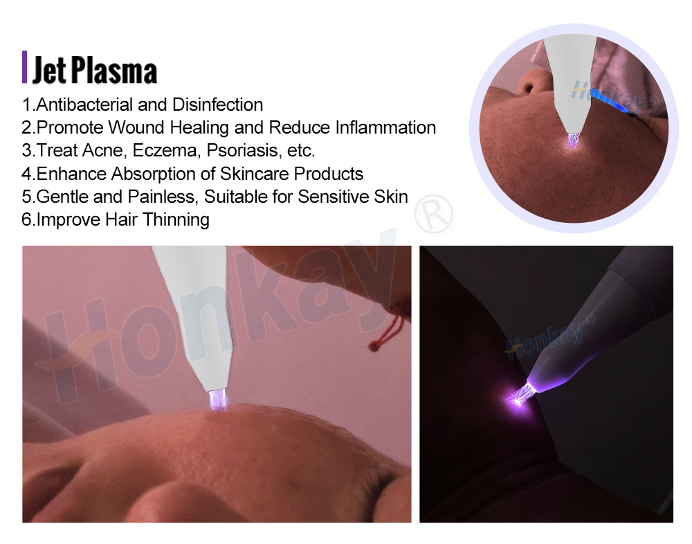 Jet plasma handpiece releasing a plasma stream above the skin without contact