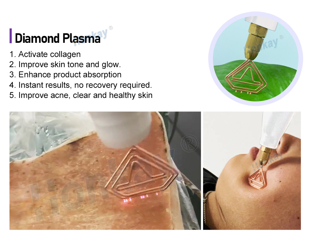 Diamond plasma triangular head moved across the skin over a serum layer