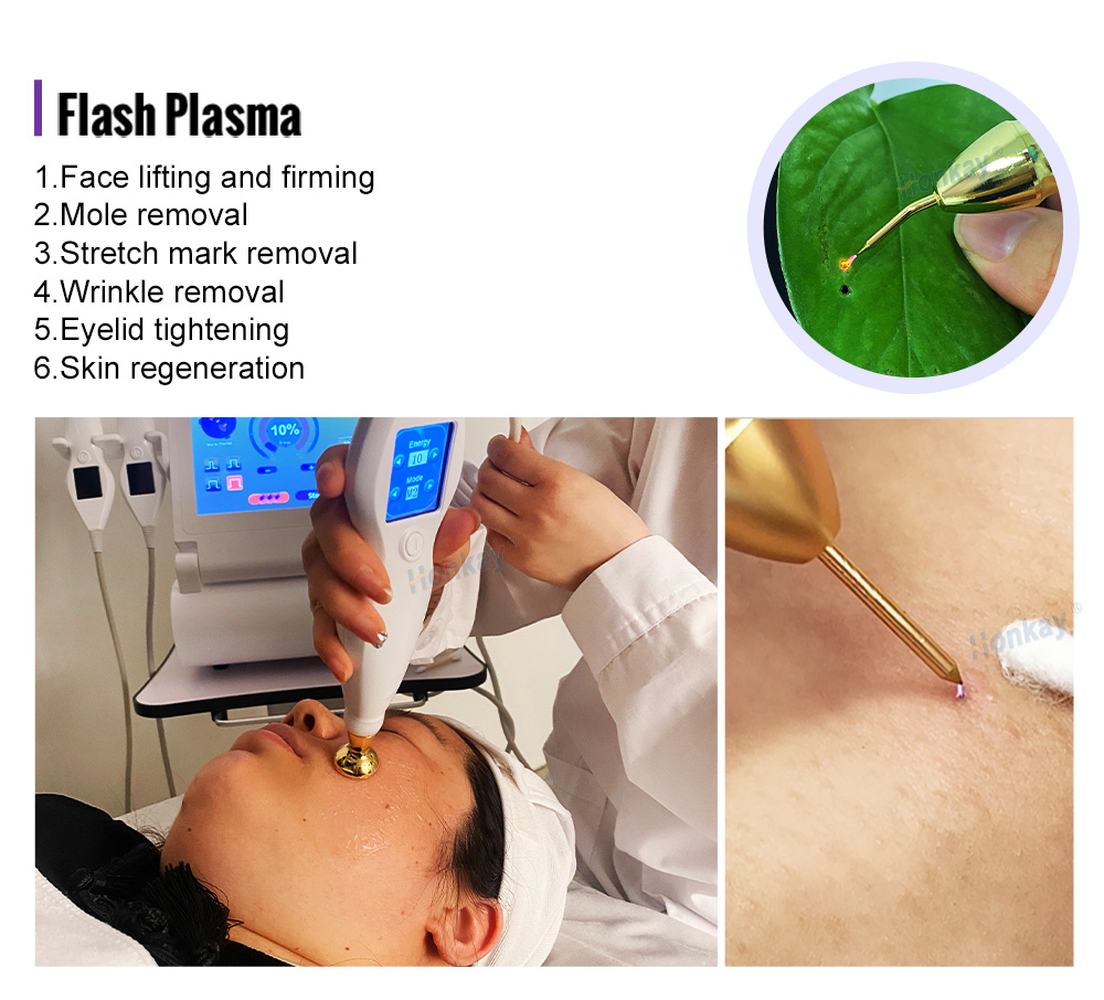 Flash plasma head used on the cheek with the handpiece energy display visible