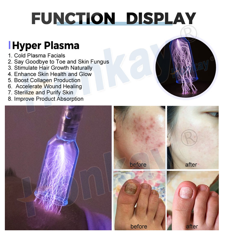 cold plasma machine