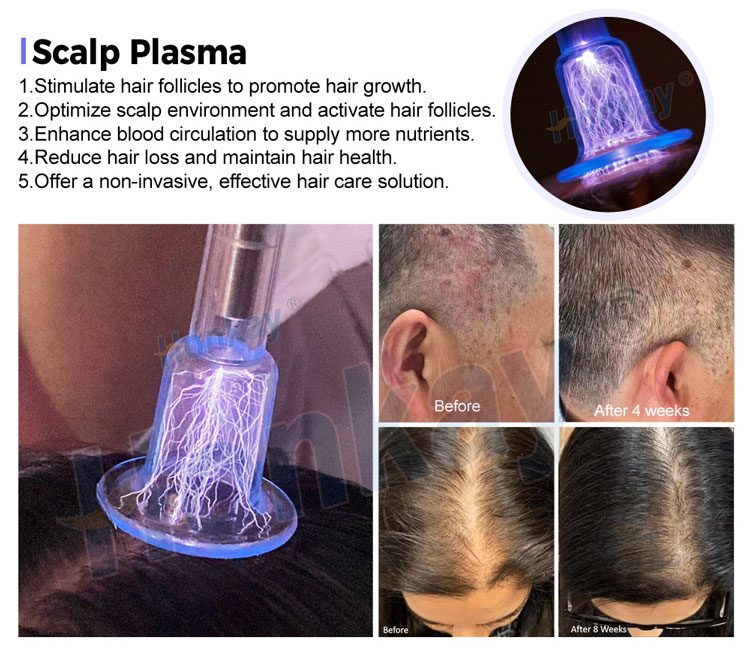 cold plasma machine