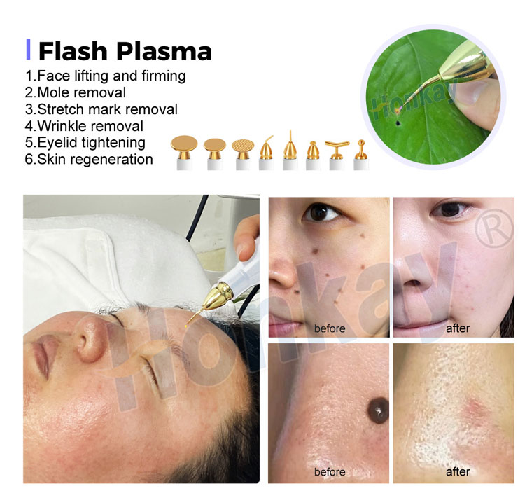 cold plasma machine