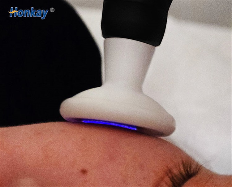 plasma handpiece applied to a treatment area with the tip held above the skin surface