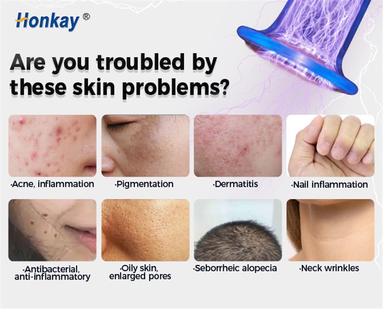 common skin concerns addressed with plasma treatment including acne pigmentation and enlarged pores