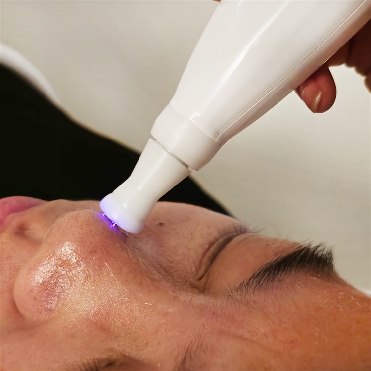 cold plasma facial treatment in progress on a client