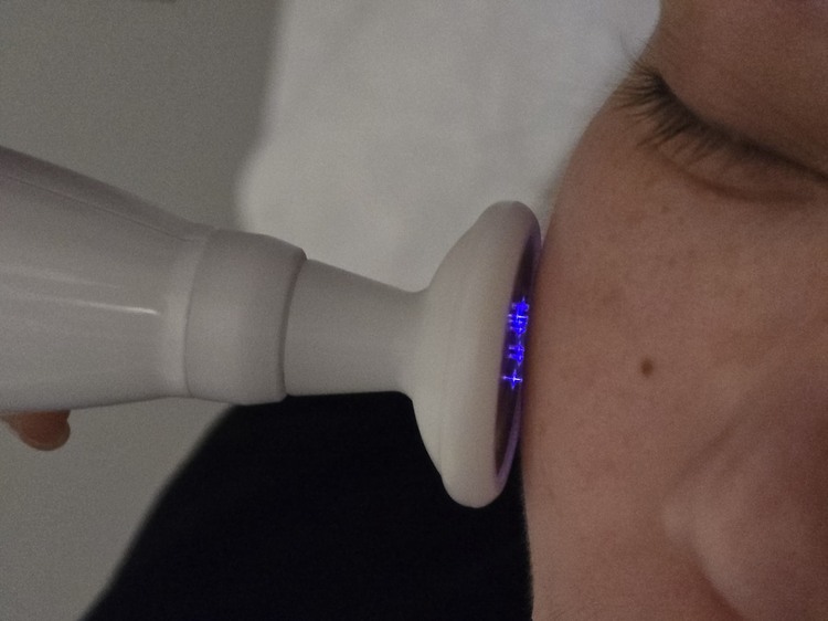 handpiece applied to the face as one step of a combination treatment