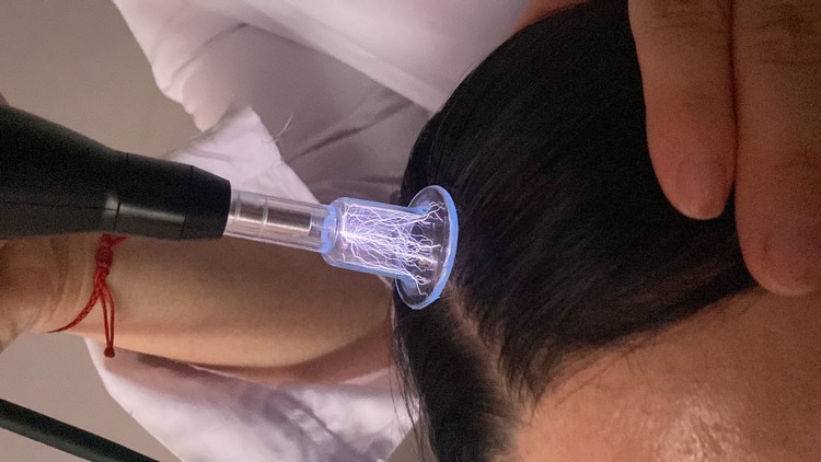 cold plasma tip working near the hairline at the side of the neck