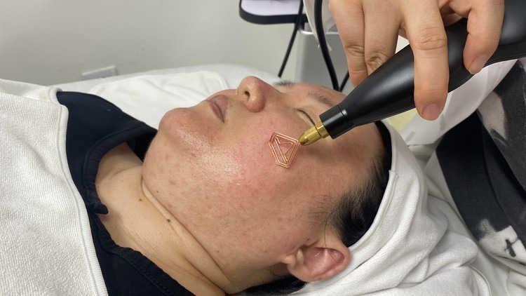 cold plasma jaw and neck treatment during a client session