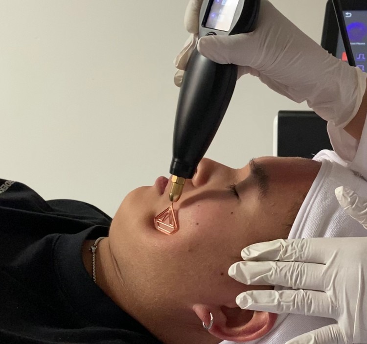 cold plasma handpiece working along the jawline of a client