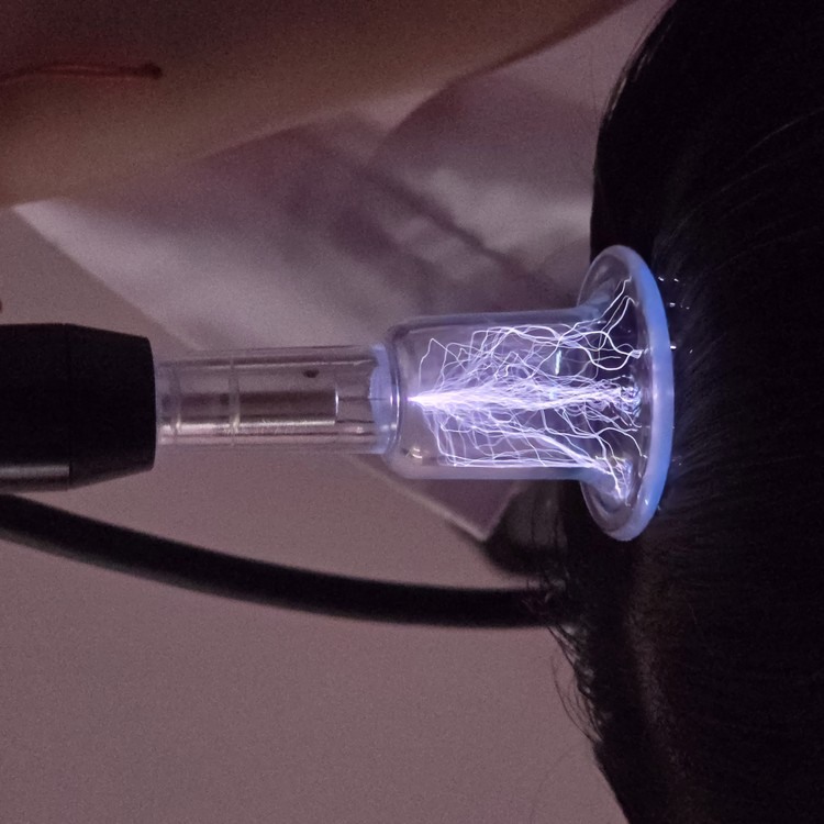 cold plasma discharge at the tip of a treatment probe