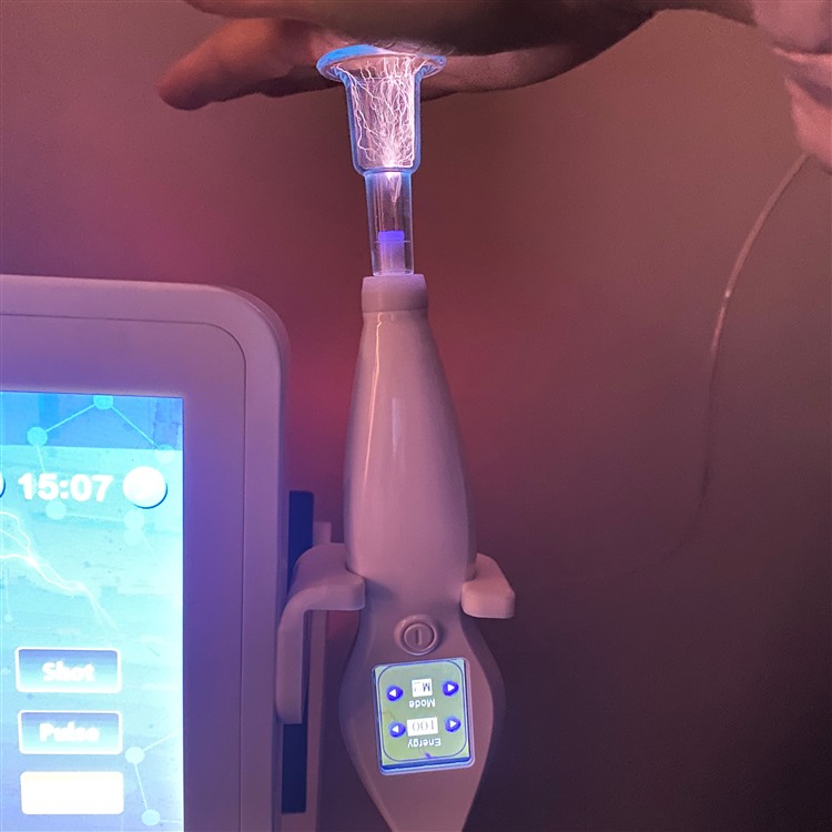 handheld plasma device showing the treatment screen